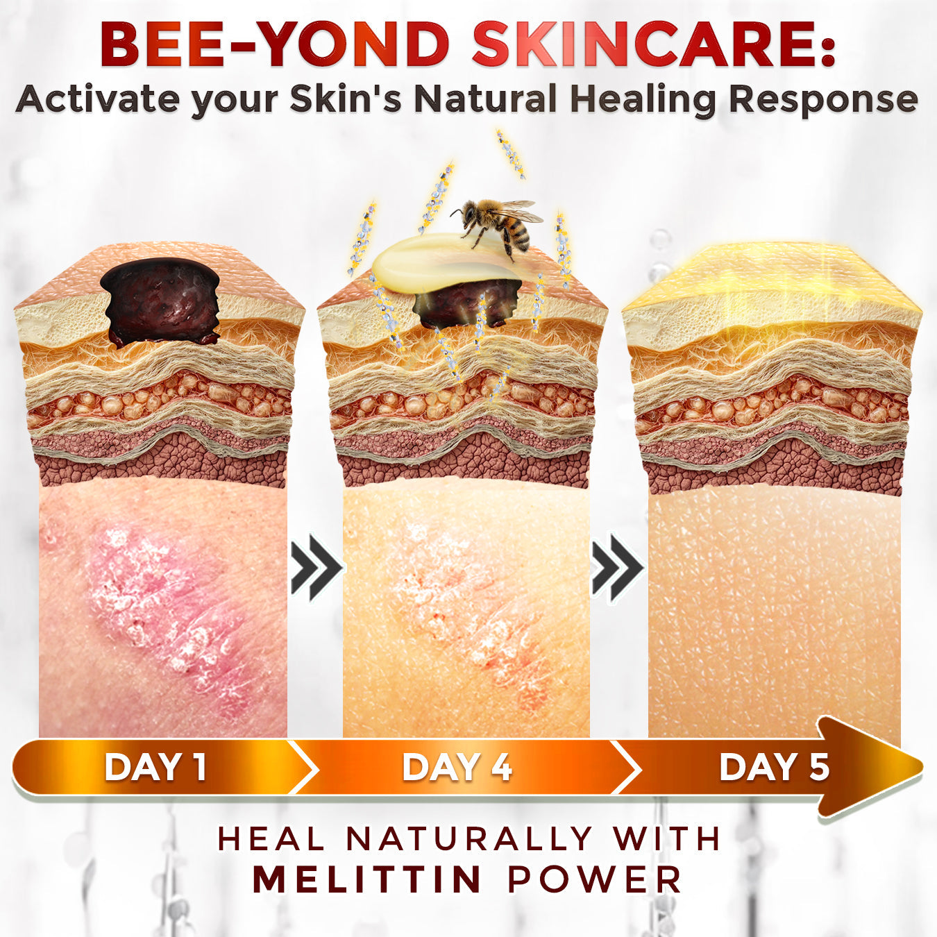 GFOUK® Bee Venom Comprehensive Repair Microneedle Cream