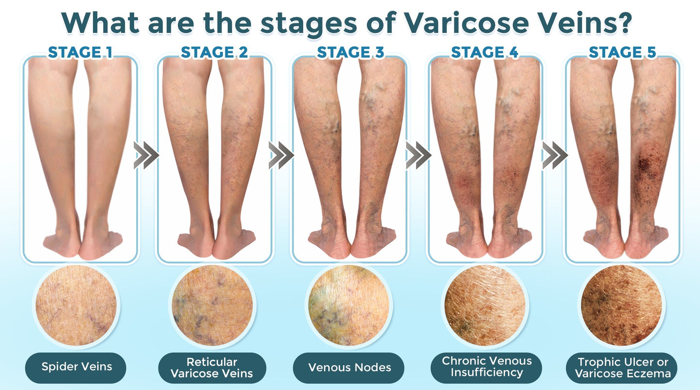 GFOUK® VenaRestore MicroNeedle Vein Repair Patch 🇨🇦